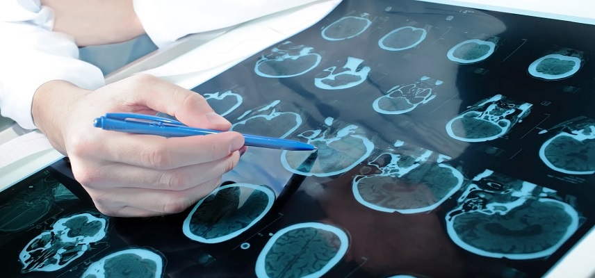Ideaya Biosciences Announces Phase 2 Expansion Dose for IDE397 Monotherapy